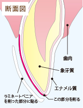 断面図